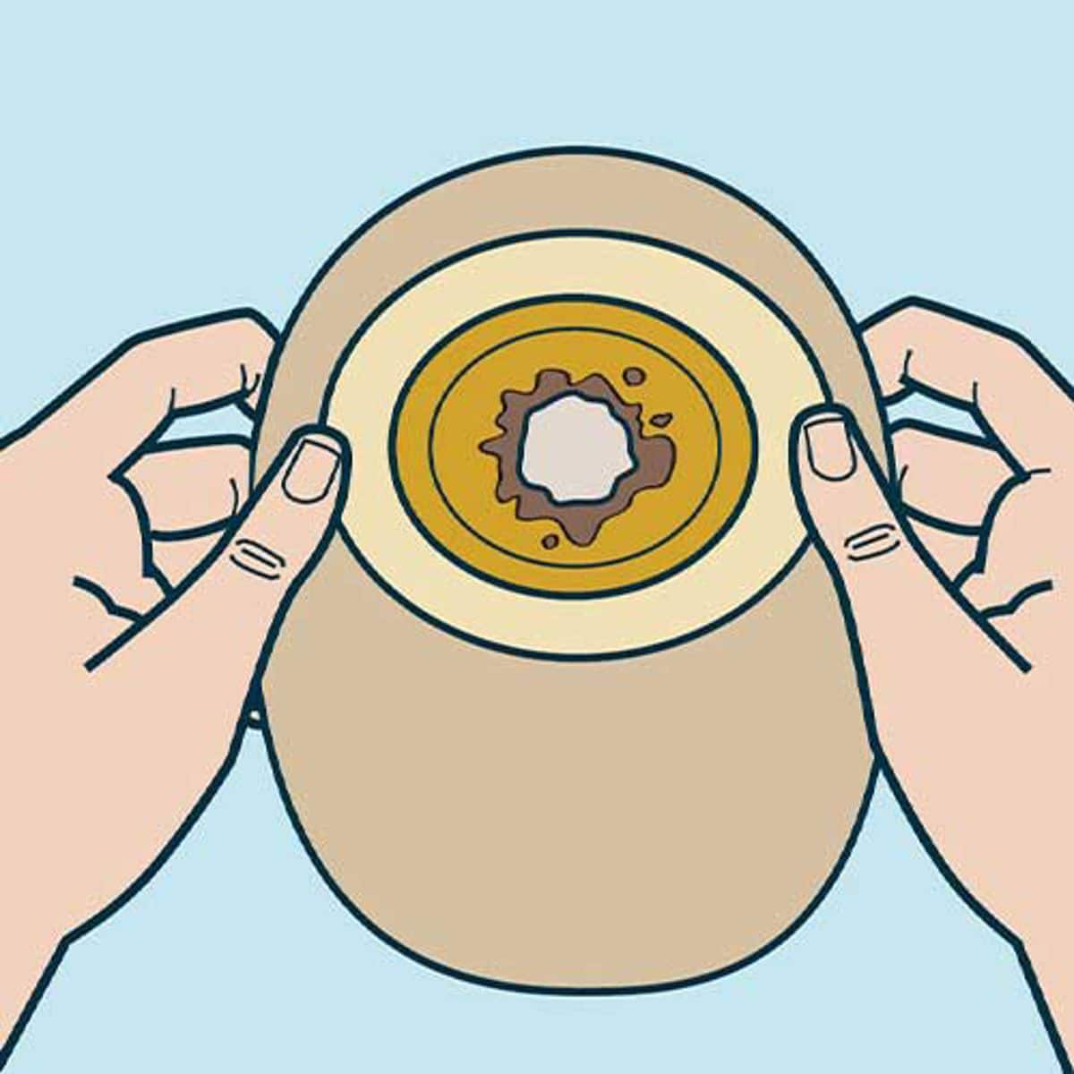 Illustrasjon av lekkasje på baksiden av en stomipose