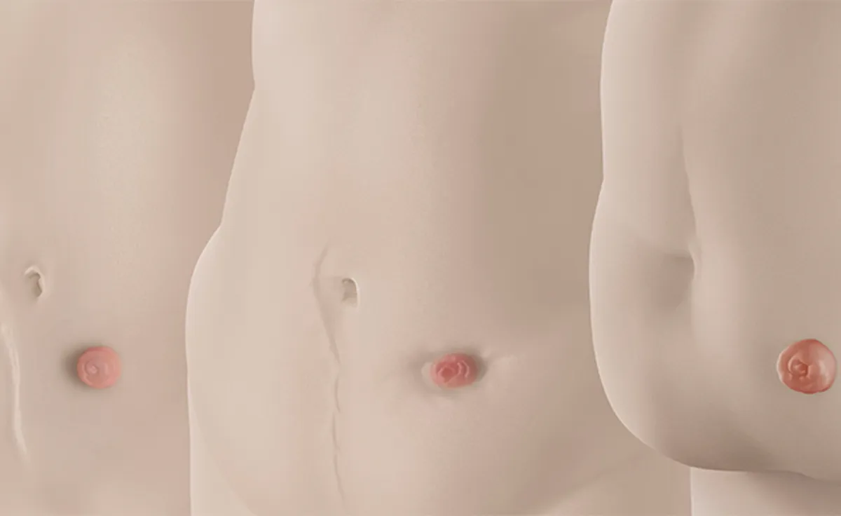 Har kroppen din forandret seg?